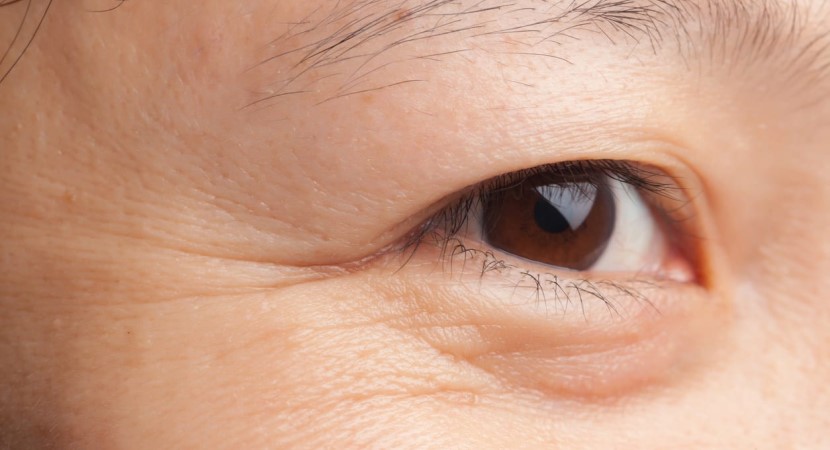 Obat Kerut Mata: Menemukan Solusi Alami Untuk Terlihat Muda